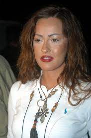 We did not find results for: Helin Avsar In Estetiksiz Hali Ile Yeni Halini Gorenler Sasti Kaldi