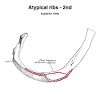 A rib has a flat body, as you can see from the picture of the anatomy of the human rib cage. 1