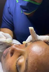 Updated Rejuvenee price list