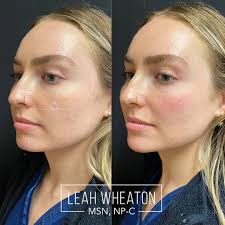 yesterday we had an amazing training where we learned to focus