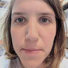 Generally, a broken nose may appear bent or crooked. Kailyn Schmidt Your Nose Is Definitely Broken Ruck Science