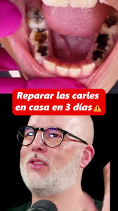 Como Eliminar Sarro De Los Dientes Frank Suarez
