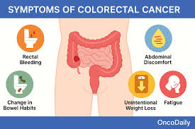Image result for Colorectal Cancer
