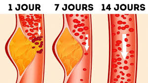 Odile jacob)*, répertorient les alimentations idéales. Qu Est Ce Que Le Regime Dash Et Pourquoi Les Docteurs Pretendent Qu Il S Agit Du Meilleur Regime Youtube