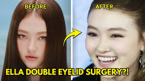 MEOVV's Ella Sparks Double Eyelid Surgery Rumors After New Photo Goes Viral 