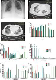 A single intravenous infusion over 60 minutes , with the potential for a second dose Correspondence On Historically Controlled Comparison Of Glucocorticoids With Or Without Tocilizumab Versus Supportive Care Only In Patients With Covid 19 Associated Cytokine Storm Syndrome Results Of The Chic Study Annals Of The Rheumatic
