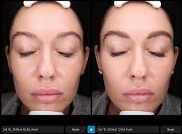 Maxine Lund, LE, ALP (@skinwithmax) • Instagram photos and videos