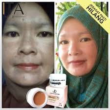Review krim jeragat, review radiance c + e shaklee. Set Jeragat Juwita Divine 100 Original Shopee Malaysia