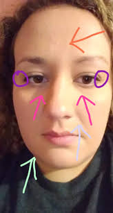 Can someone even out my forehead color?