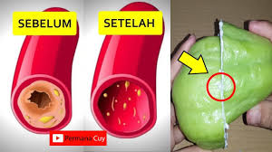 7 cara efektif menurunkan kolesterol secara alami dan mudah. Subhanallah Begini Cara Menurunkan Kolesterol Dengan Cepat Youtube
