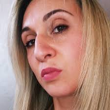 posta Ciao a tutte a mio figlio qualche mese è spuntata una verruca sotto  l'ascella , diagnosi “ mollusco contagioso “ cura “ andranno via da soli” A  distanza di due mesi