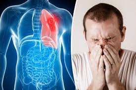 Learn about the common signs and symptoms of lung cancer such as a worsening cough, loss of appetite, or shortness of breath. Lung Disease Symptoms Six Signs You Could Have A Deadly Respiratory Condition Daily Star