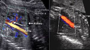 Pin On Ob Gyn Utrasound 301 Mod 4