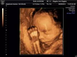 Check spelling or type a new query. What Is The Fourth Dimension Of The Pregnancy 4d Ultrasound Quora