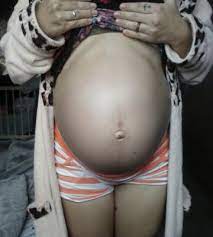Foto Da Barriga De 36 Semanas 1 Dia Me Sentindo Estranha Demais Agosto De 2015 Babycenter