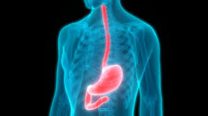 The incisions are made in the neck, chest and abdomen (belly) to remove the esophagus and rebuild the gastrointestinal tract. Cpt 2018 Quiz Laparoscopic Esophagectomy Aapc Knowledge Center