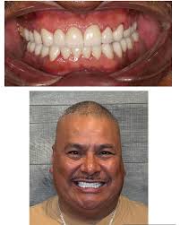 Main Street Dental Center (@mainstreetdentaltx) • Instagram photos and  videos