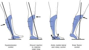 Seated isometric knee flexion torque was higher in the seated versus supine position and with the foot. Lower Limb Orthotic Devices Clinical Gate