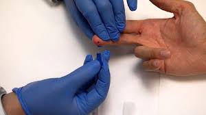 Pengertian Rapid Test Swab Dan Pcr Untuk Deteksi Virus Corona Yang Perlu Kamu Tahu Tribun Jogja