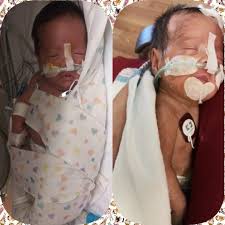 Mother's experience with son's cancer treatment