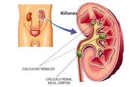 Resultado de imagen de limpieza riñones