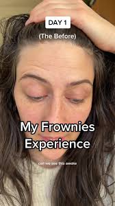 A chaotic video recapping my @frowniesfamily experience! And watch me  visibly get sick over the course of a week 😂 If you want a discount I have  one linked up! #frowniesfacialpatches #tensionheadache ...
