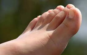 A nonhealing ulcer that causes severe damage to tissues and bone may require surgical removal (amputation) of a toe, foot or part of a leg. Diabetic Foot Ulcer Symptoms Causes Treatment Medicine Prevention Diagnosis