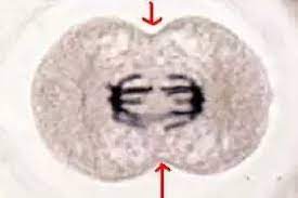 We did not find results for: Do You Find A Cleavage Furrow In Mitotic Plant Cells Quora