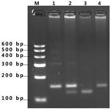 We typically see these, or we monitor these, by isolating the dna, cutting it with. An Improved Polymerase Chain Reaction Restriction Fragment Length Polymorphism Assay For The Detection Of A Pon2 Gene Polymorphism