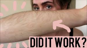 We understand that these are the most intimate areas of your body, and many people shy away from having someone else work with this sensitive region. Bleaching My Arm Hair Youtube