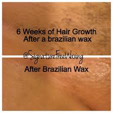 Top Photo 6 Weeks After Receiving A Brazilian Wax At Signature Free Waxing Bottom Photo After Brazilian Waxing Waxing Before And After Waxing Tips Brazilian