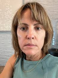 Vivitrol with gabapentin for alcohol sobriety maintenance?