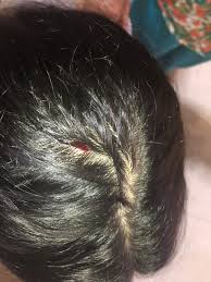 Joven Resulta Herida Con Un Objeto Que Le Cayo En La Cabeza Dentro Del Portal Del Prado Noticias Barranquilla