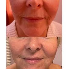 LA CHELE MEDICAL AESTHETICS