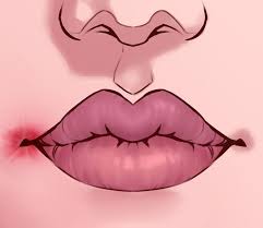 Bintik merah pada kulit bisa disebabkan oleh banyak faktor yang mungkin patut diwaspadai seperti berikut. 8 Tanda Kesehatan Bisa Dilihat Dari Kondisi Bibir Salah Satunya Bibir Pecah Pecah Yuk Jangan Dibiarkan Saja Semua Halaman Intisari