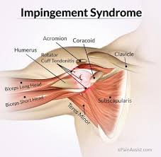 Pin On Shoulder Injuries Rehabilitation