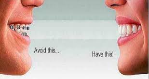 Curious about braces cost in malaysia? Cheap Invisalign Abroad Mexico Costa Rica Thailand Low Cost Invisible Braces