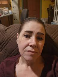 Jelly like feeling after dental implant surgery?