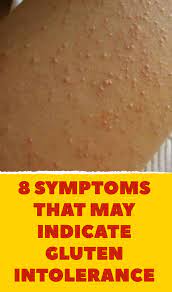 8 Symptoms That May Indicate Gluten Intolerance Gluten Intolerance Symptoms Gluten Intolerance Symptoms Signs Gluten Intolerance Skin