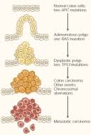 The earlier you detect cancer, the better the chances of survival. Cell Division Cancer Learn Science At Scitable