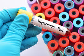 Image result for Triglyceride