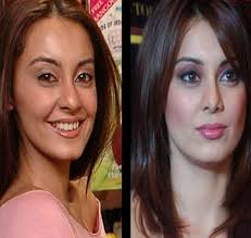 10 Most Embarrassing Bollywood Surgeries Therefore, it is significant to analyze distinct characteristics and bring out one's beauty rather than creating an identical and conventional nose shape. 10 most embarrassing bollywood surgeries
