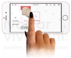 Ips Emax Shade Navigation App Bremadent Dental Laboratory