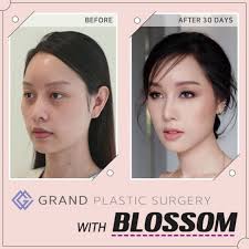 Eye Bag Surgery Surgery Surgery Tumblr Plastic Surgery Korean Plastic Surgery Dermatologist Skin Care