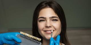 Porcelain Veneers Vancouver BC