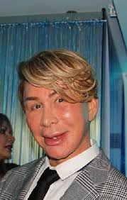 Así ha sido el radical cambio físico de Norberto