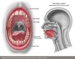 Image result for spinocellular carcinoma of the oral cavity