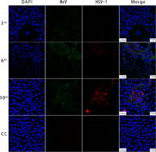 Hsl and hsv are both cylindrical geometries (fig. The Detection And Characterization Of Herpes Simplex Virus Type 1 In Confirmed Measles Cases Scientific Reports