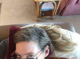 'should i use a cold cap?' is one of the most common questions about chemotherapy asked by women on. Breast Cancer Topic Cold Cap Before And After Photos