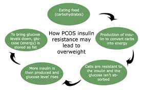 Pcos Diet Guideline Natural Treatment For Insulin Resistance